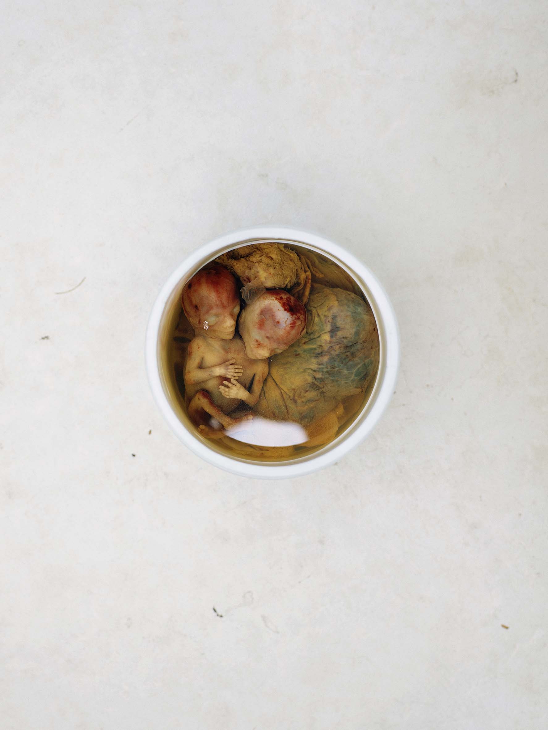 Pieter Hugo - At the medical school, Oaxaca, 2018