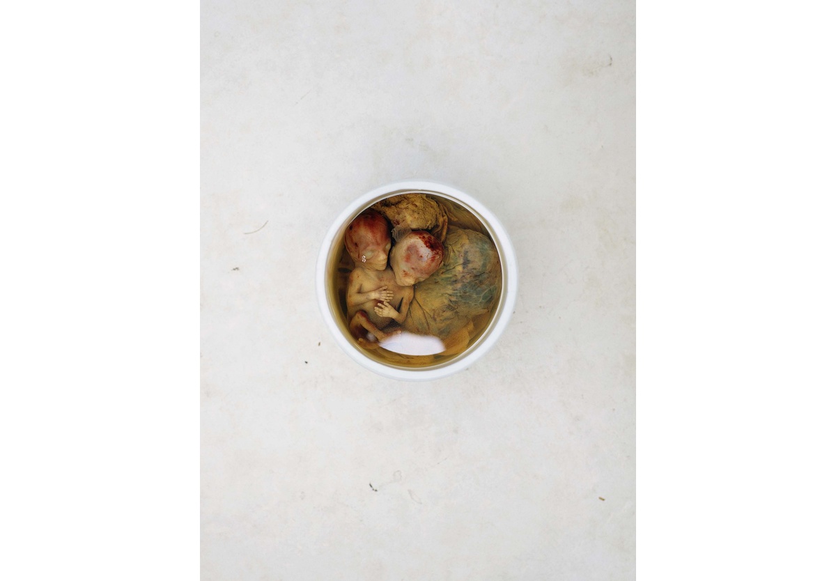 Pieter Hugo - At the medical school, Oaxaca, 2018