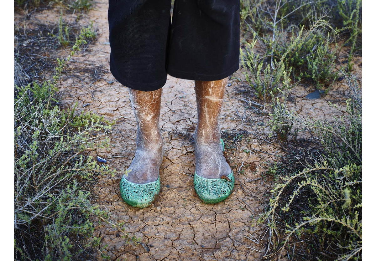 Pieter Hugo - The feet and legs of Natasha Williams, Sarah Baartman District, 2013